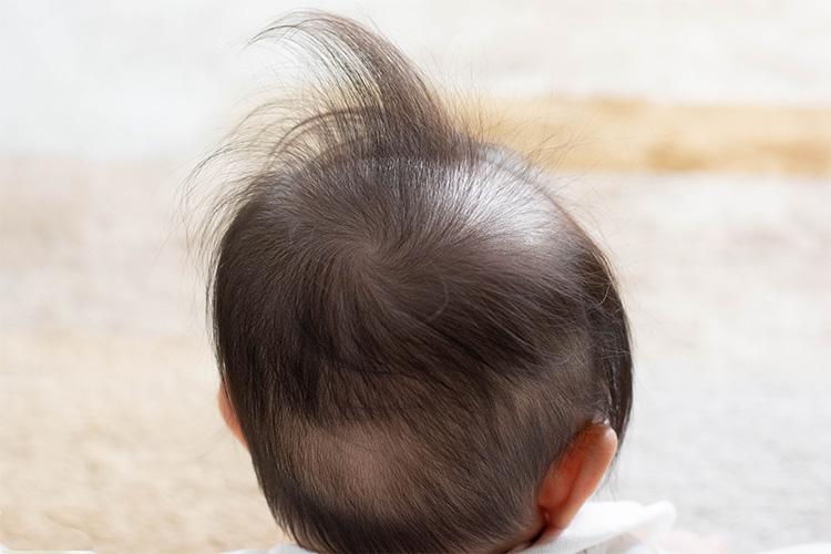 産毛が増えるのはどういうサイン？